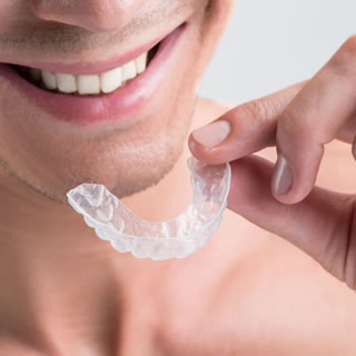 in house clear aligners